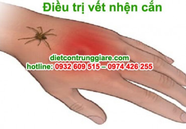Cách điều trị vết nhện cắn